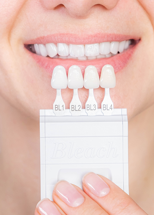 A woman smiling with a dental veneer sample held in front of her teeth.
