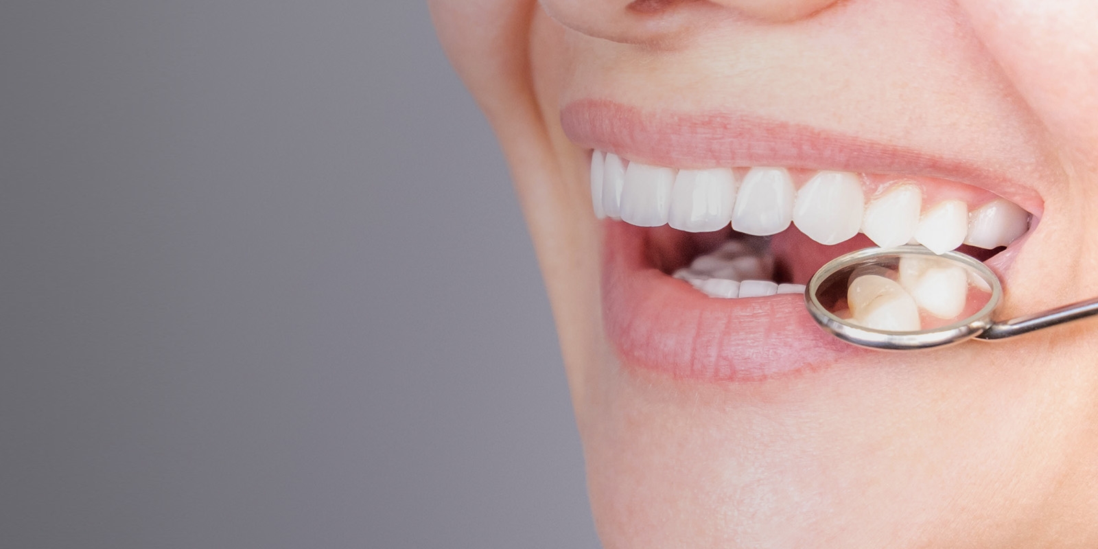 Close-up of a smile with a dental mirror near the teeth.